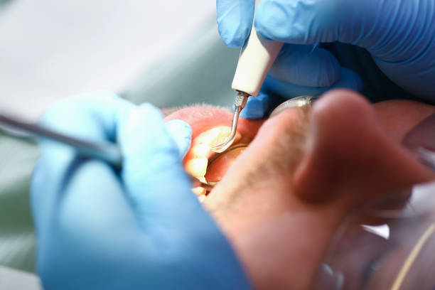 Best Emergency Dental Care for Trauma or Injury in Belcourt, ND
