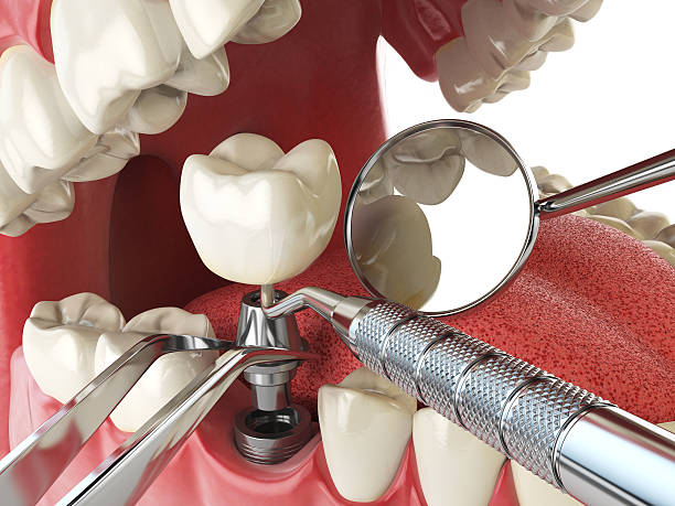 Best Emergency Broken Tooth Repair in Belcourt, ND