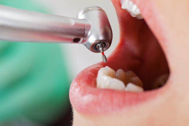 Best Emergency Treatment for Toothache in Belcourt, ND